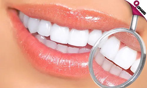 Teeth Whitening & More!